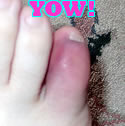 Ouch